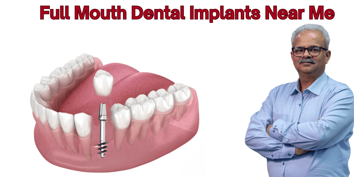 Read more about the article Full Mouth Dental Implants Near Me: Affordable Tooth Replacement Cost And Finding The Right Dental Implant Clinic Near Me